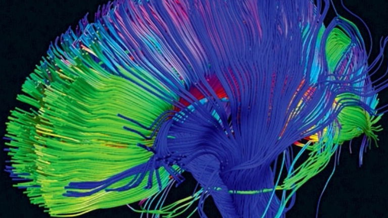 LSD y el nuevo orden en tu cerebro