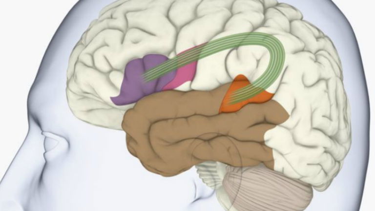 Cómo tu cerebro puede dejarte sin habla