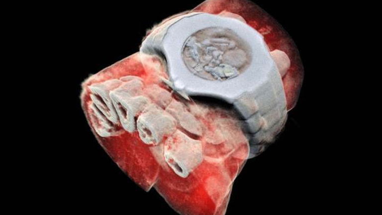 Llegan las radiografías en 3D: simplemente impresionantes
