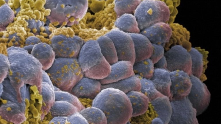 Un nuevo sistema consigue detectar tejidos cancerosos de forma más efectiva