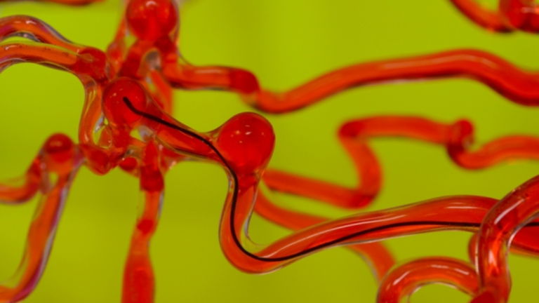 Un gusano robótico podría ser la clave para solucionar dolencias cerebrales