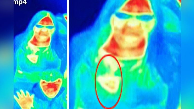 La atracción que ayudó a detectar un cáncer de mama
