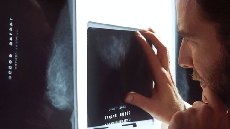 ChestLink, así es la tecnología que lee radiografías con precisión gracias a su Inteligencia Artificial