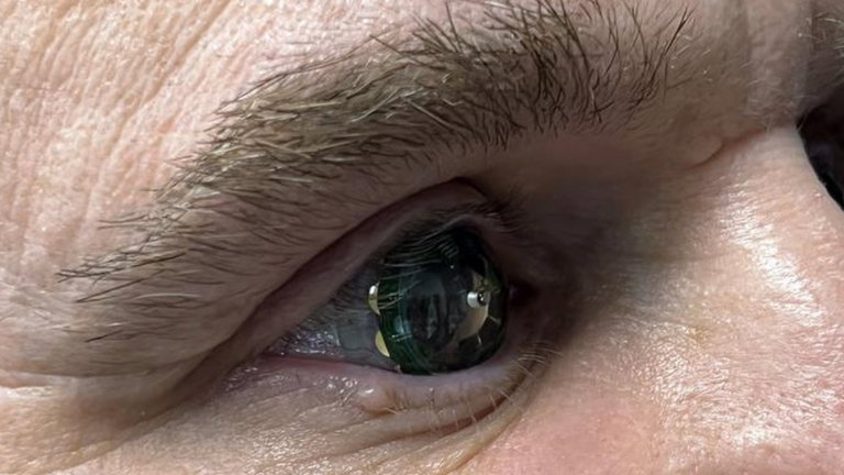 Un procesador de ARM, una pantalla de 14.000 píxeles y baterías en tu ojo: así son las Mojo Lens