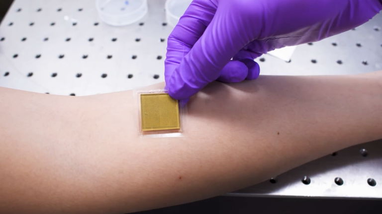 De las calcomanías a las pegatinas para ver el interior del cuerpo humano: así son las ecografías del MIT