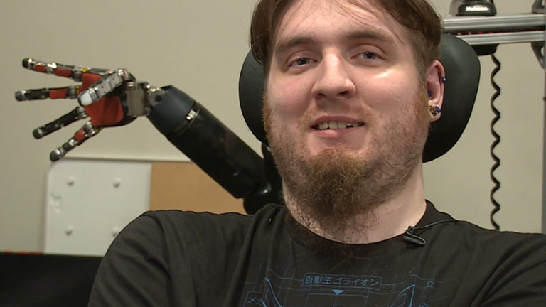 Este hombre no tiene cerebro, tiene un superordenador que le permite controlar dispositivos con la mente