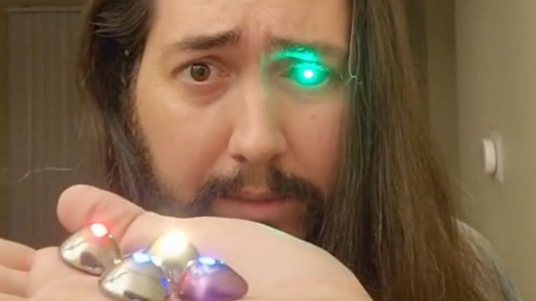 Este hombre perdió un ojo por el cáncer, así que decidió convertirse en un cyborg