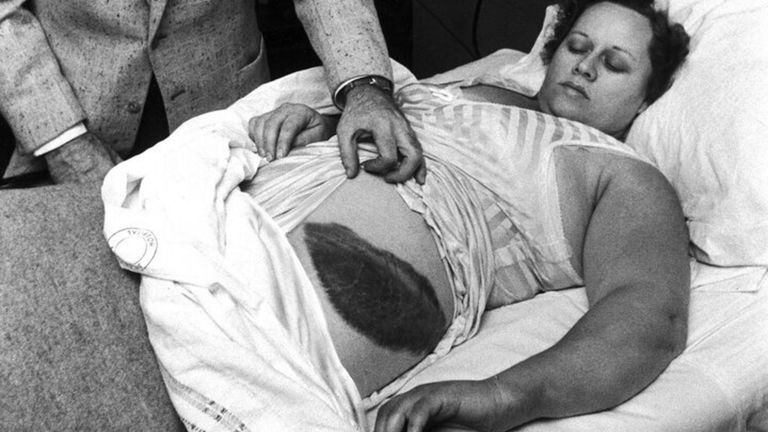 Esta mujer es la única persona que ha recibido un impacto de meteorito, y aunque no lo creas, sobrevivió