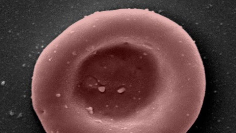 Se ha llevado a cabo la primera transfusión con sangre artificial, un hito histórico para la medicina