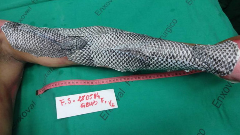 Una armadura de escamas de pescado, el mejor tratamiento para cuidar tu piel