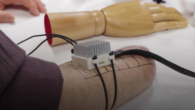 Revolución para las prótesis: este prototipo biónico transmite sensaciones térmicas