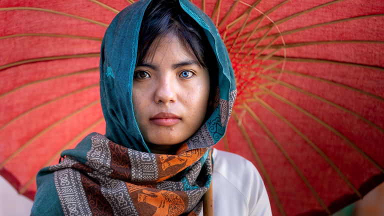 Heterocromía: por qué hay gente con un ojo de cada color