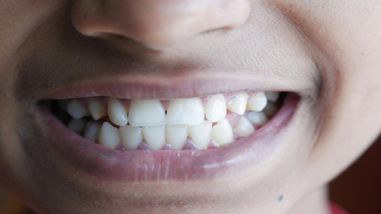 Ir al dentista puede que se convierta en algo del pasado: los expertos pretenden que renovemos nuestros dientes de forma natural