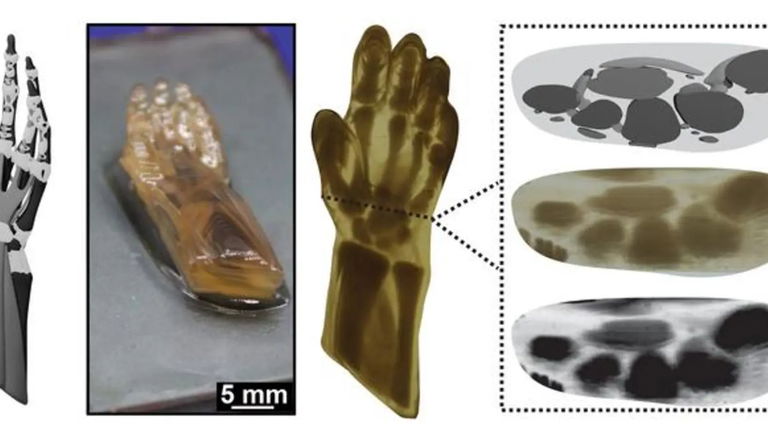 La impresión 3D podría ayudar a recuperar miembros amputados (y a bajo coste) de esta forma