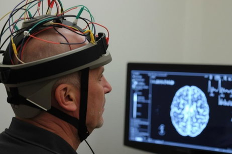 China desafía a Neuralink con la primera aprobación comercial mundial para un implante cerebral